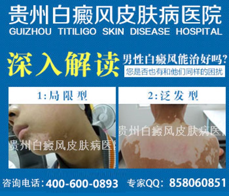 湿疹医院：探索更全面的治疗之道
